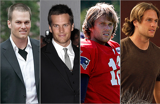 tom-brady-hair-transplant.jpg