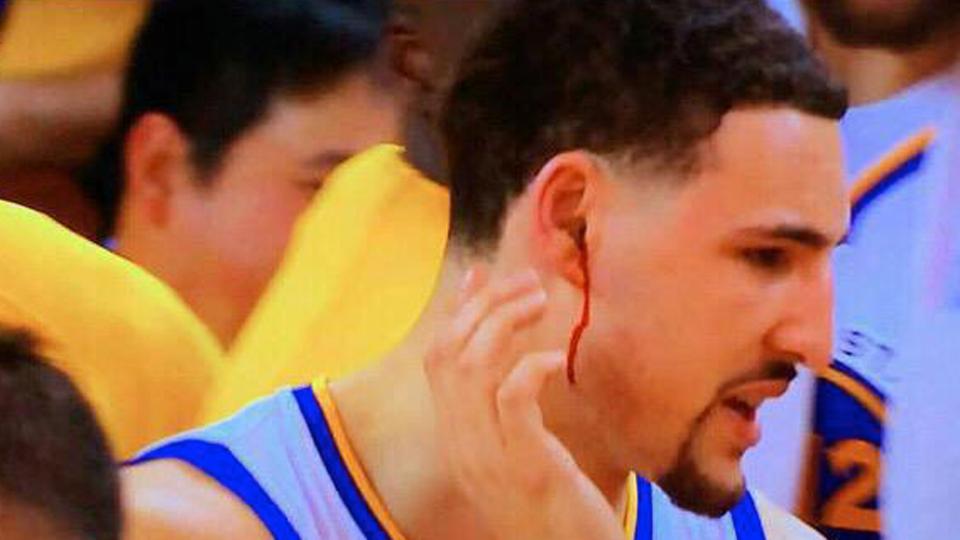 Klay Thompson may have concussion after knee to head ...